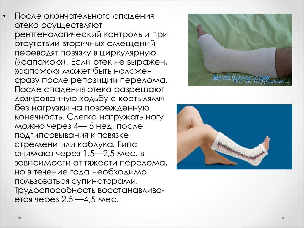 Повреждение голеностопного сустава код по мкб 10