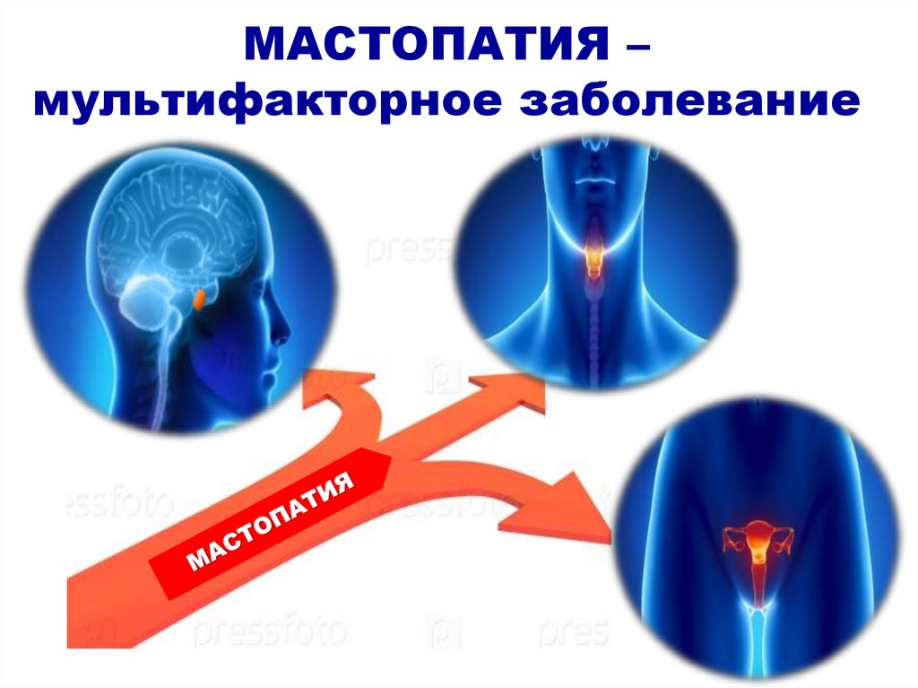 Схема харриса мультифакторные заболевания