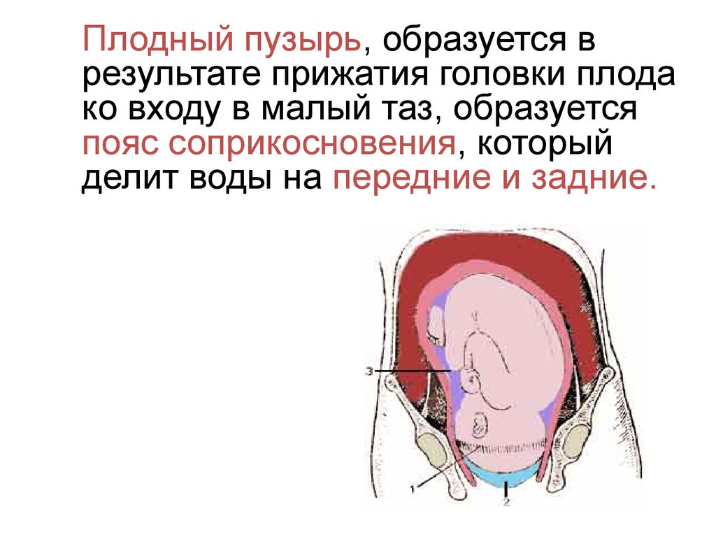 Через сколько схватки после прокола пузыря. Образование и функции плодного пузыря. Пояс соприкосновения в акушерстве. Пояса соприкосновения плодного пузыря.