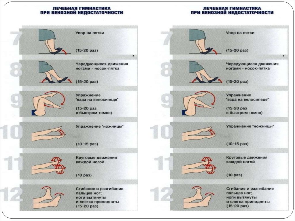 Как лечить венозную недостаточность. Упражнения при венозной недостаточности. Лечебная гимнастика при венозной недостаточности нижних конечностей. Йога для венозной недостаточности. ЛФК при венозной недостаточности нижних конечностей.