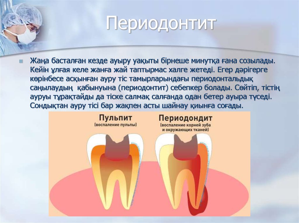 Периодонтит детская стоматология презентация