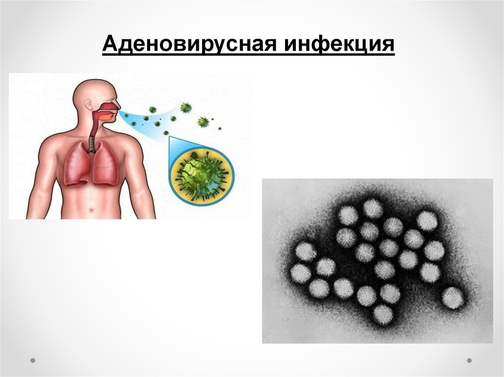 Аденовирус гриппа. Аденовирусная инфекция эпидемиология. Аденовирусная инфекция пути заражения. Аденовирусная инфекция этиология. Аденовирус способ передачи.