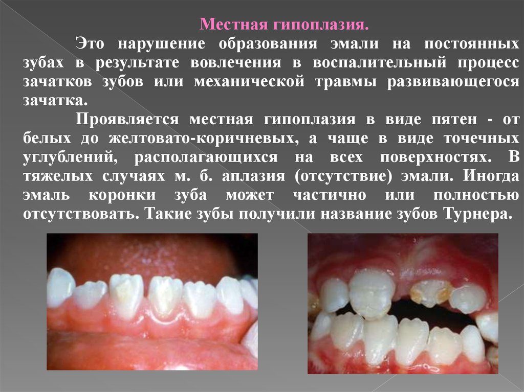 Расстройства психосоматического спектра патогенез диагностика лечение руководство для врачей