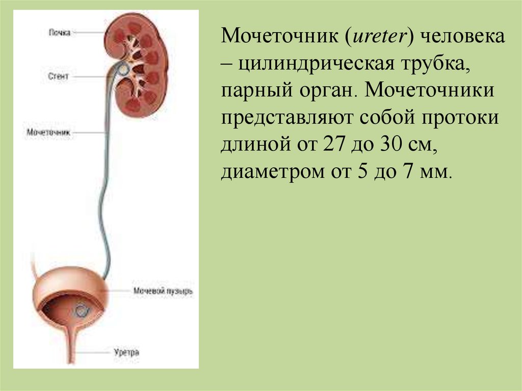 Стенд на мочеточнике фото