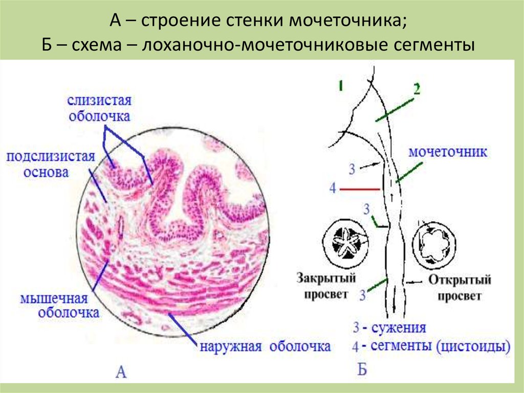 3 части мочеточника