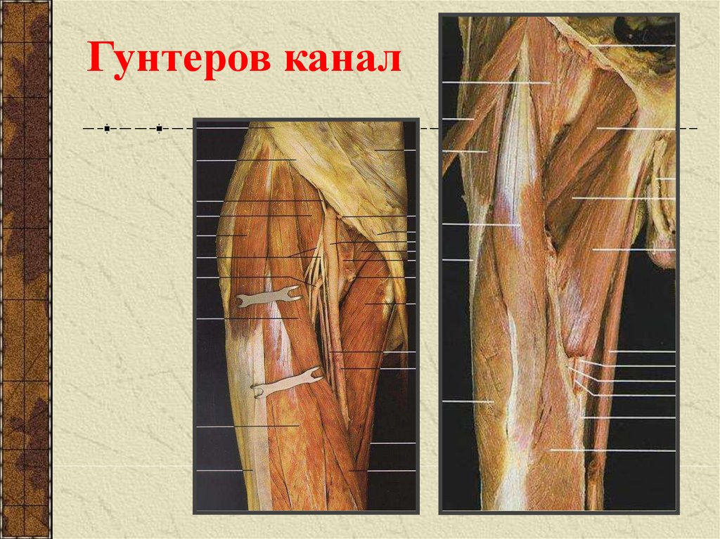 Содержимым приводящего канала являются. Гунтеров канал топографическая анатомия. Бедренно-подколенный приводящий канал. Бедренно подколенный канал Гунтера. Канал Гюнтера топография.