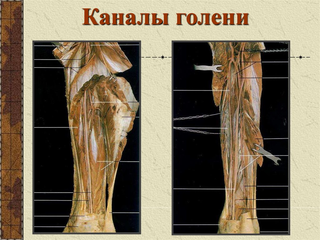 Груберов канал. Топография подколенной ямки и голени. Canalis cruropopliteus анатомия. Каналы голени топографическая анатомия. Топография голени топографическая анатомия.