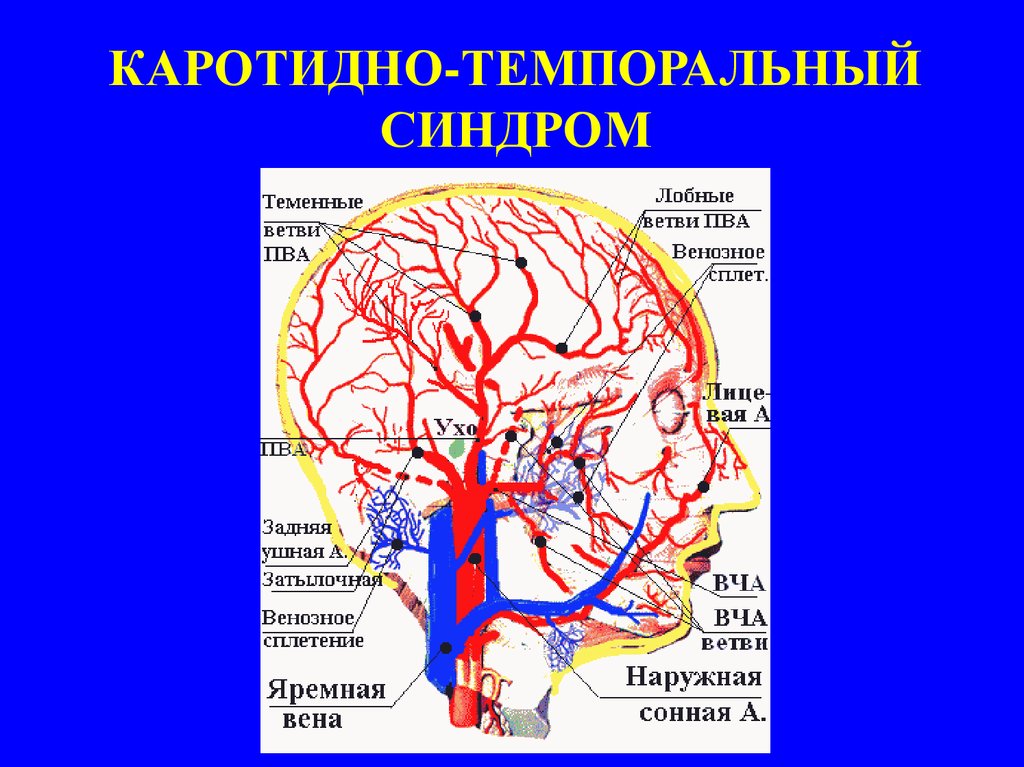 Каротидно феморальная спв