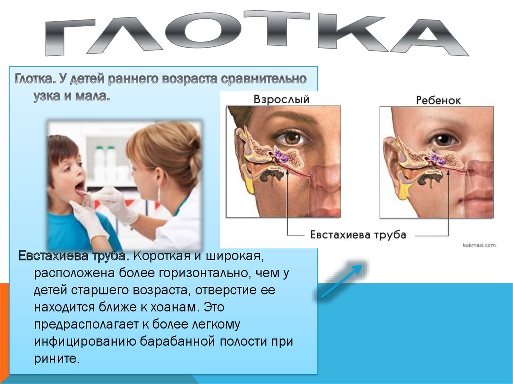 Презентация инородные тела глотки