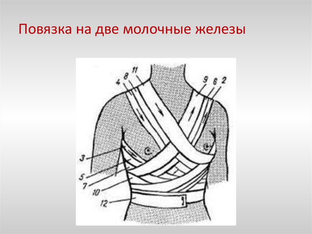 Повязка дезо техника наложения в картинках пошагово