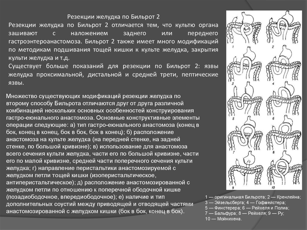 Бильрот 1 и 2 отличия схема