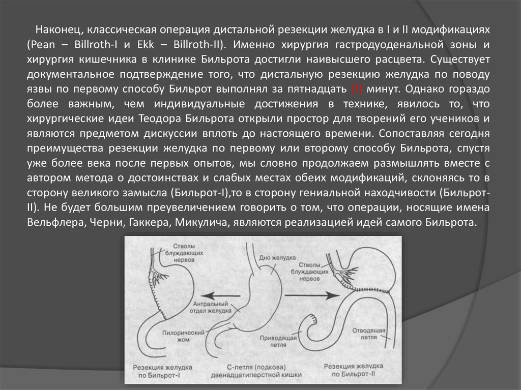 Резекция желудка по витебскому схема операции