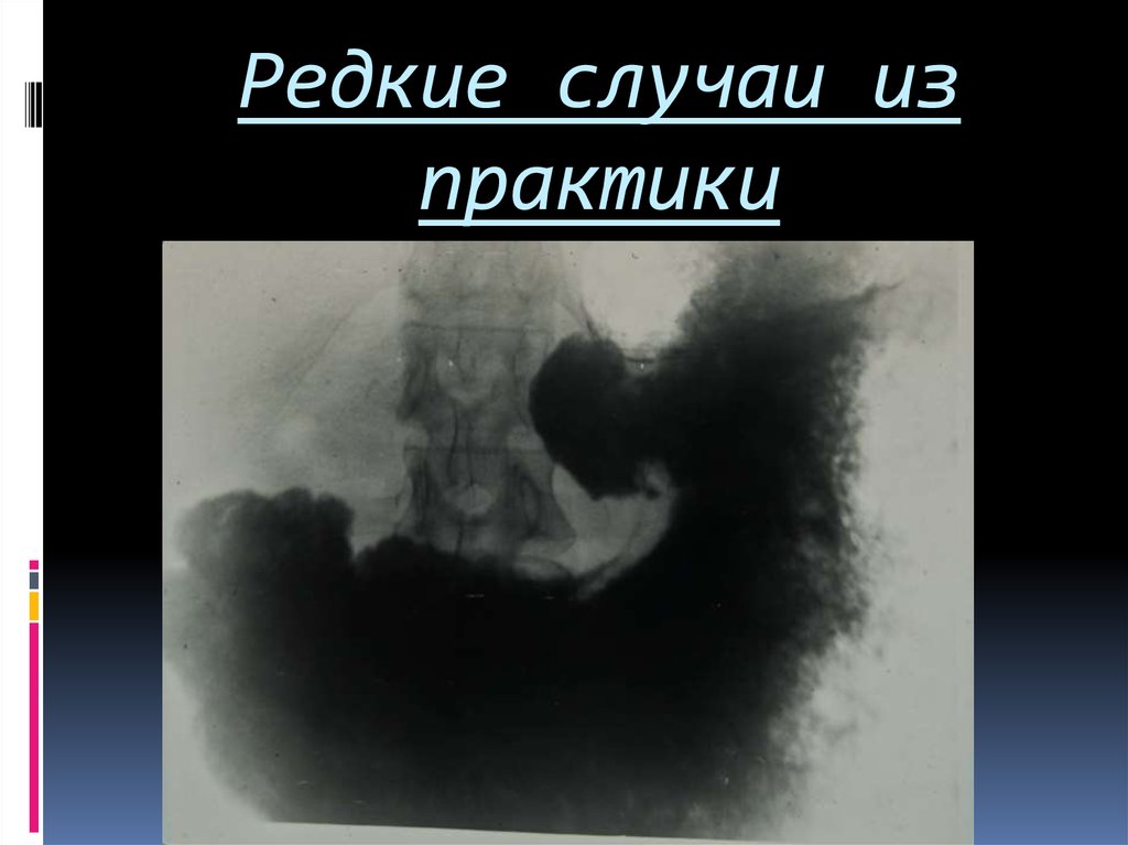 Редкие случаи из практики