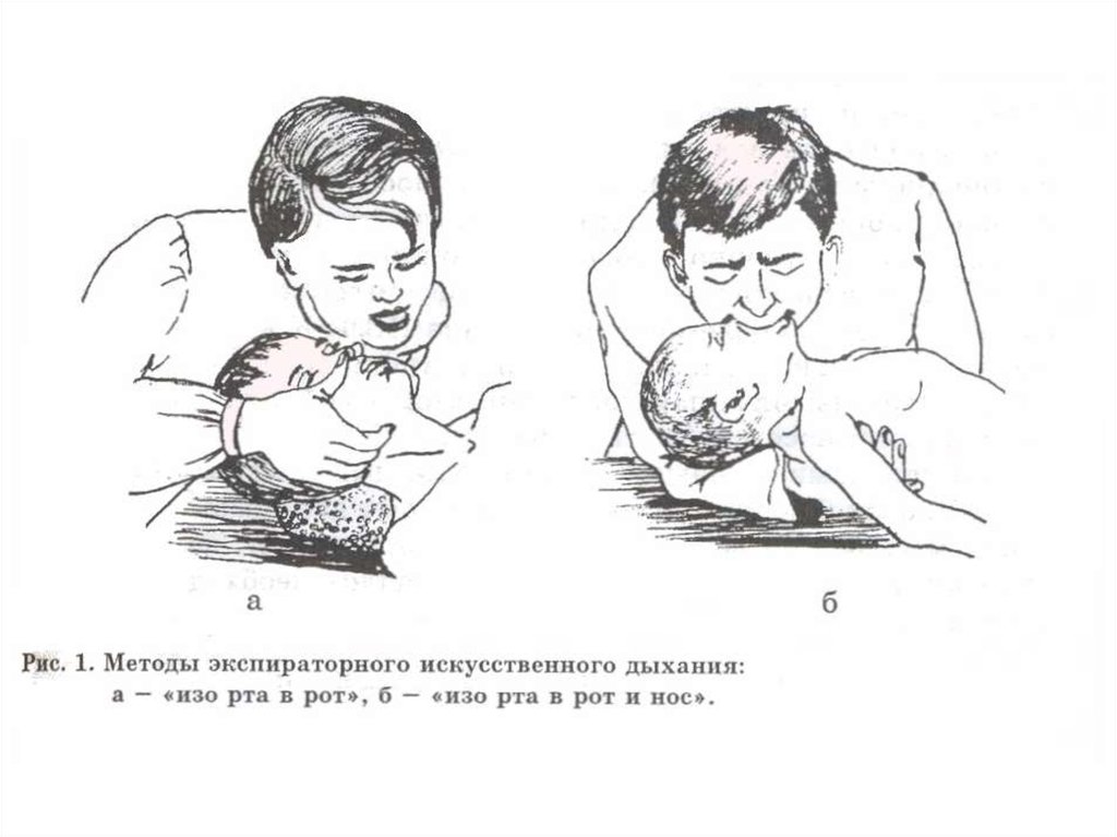 Неотложные состояния у детей презентация