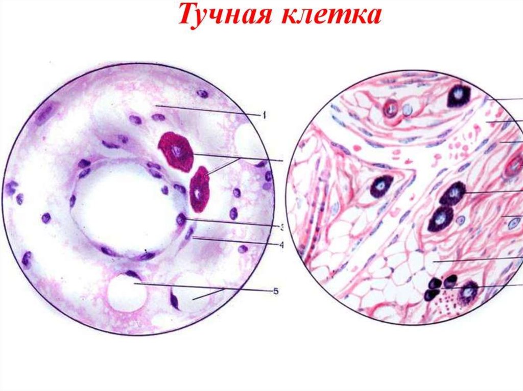 Тучные клетки. Тучные клетки гистология функции. Тучные клетки гистология препарат. Тучные клетки лаброциты гистология. Тучная клетка строение гистология.