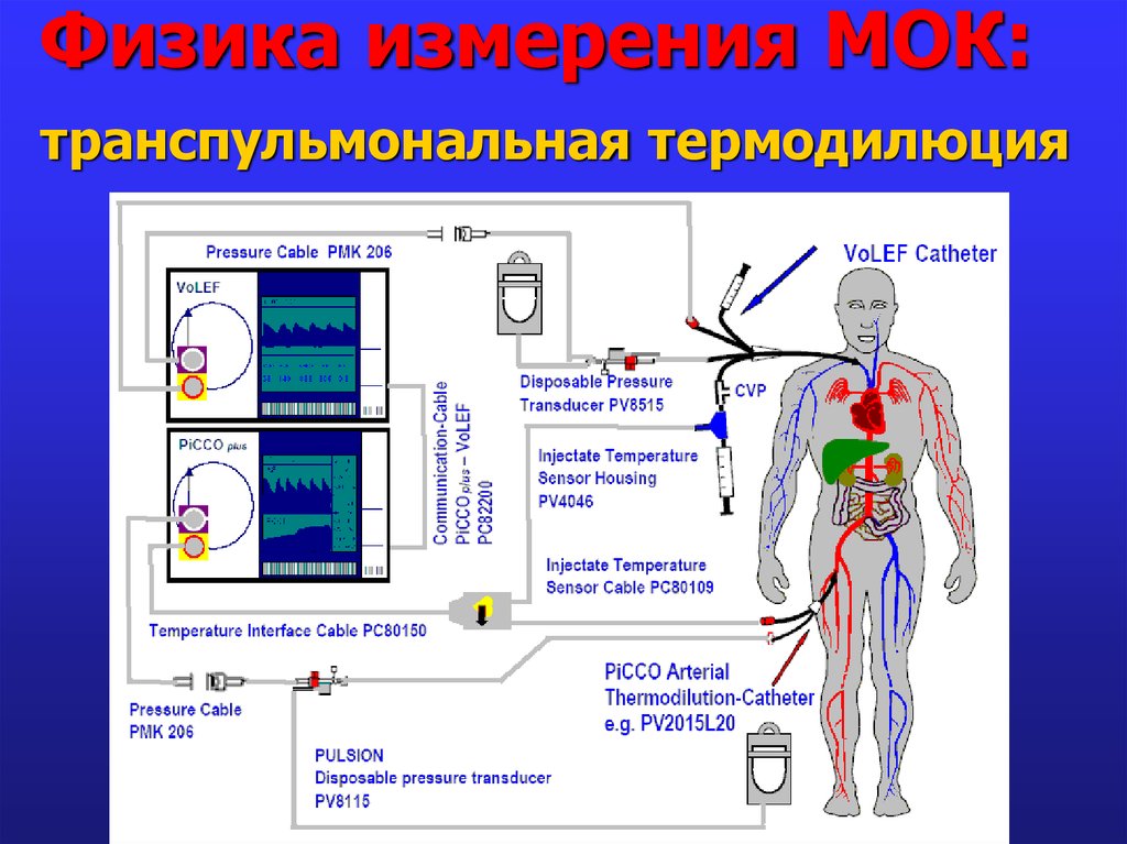 Физик измеривший. Транспульмональная термодилюция. Транспульмоналтная те. Мониторинг транспульмональной термодилюции. Измерение сердечного выброса методом термодилюции.