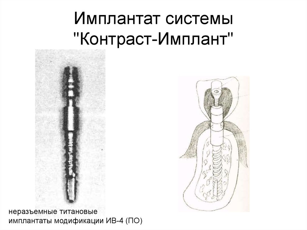 Остеоинтеграция имплантата презентация