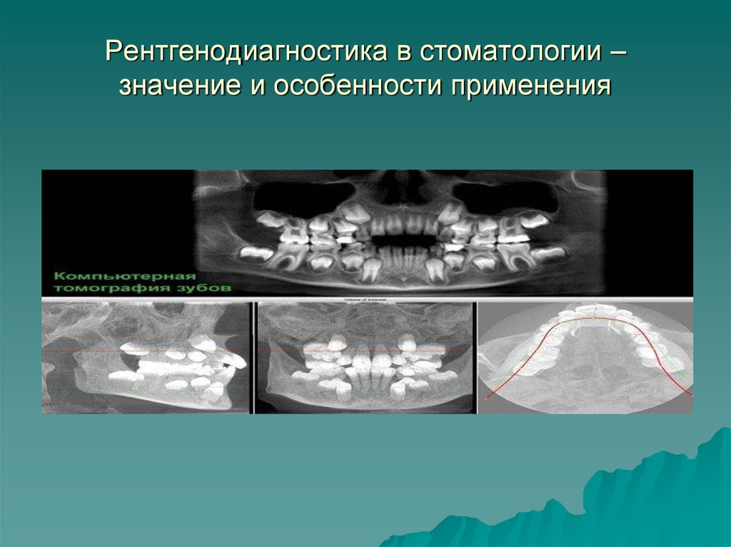 Дентальная фотография презентация