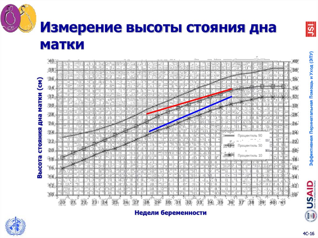 Высота стояния дна матки