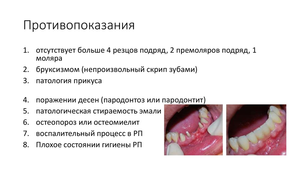 Противопоказания