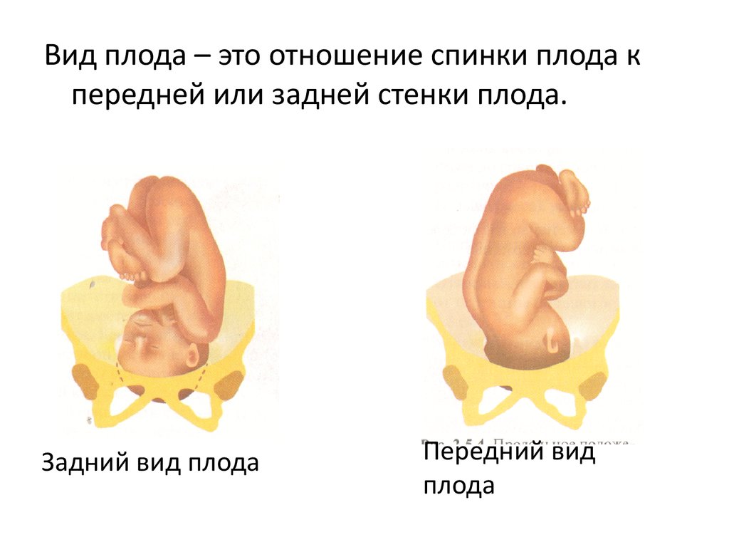 Продольное положение плода. Вид позиции плода. Продольное головное предлежание 2 позиция. Положение предлежание вид и позиция плода. Положение плода головное 1 позиция.