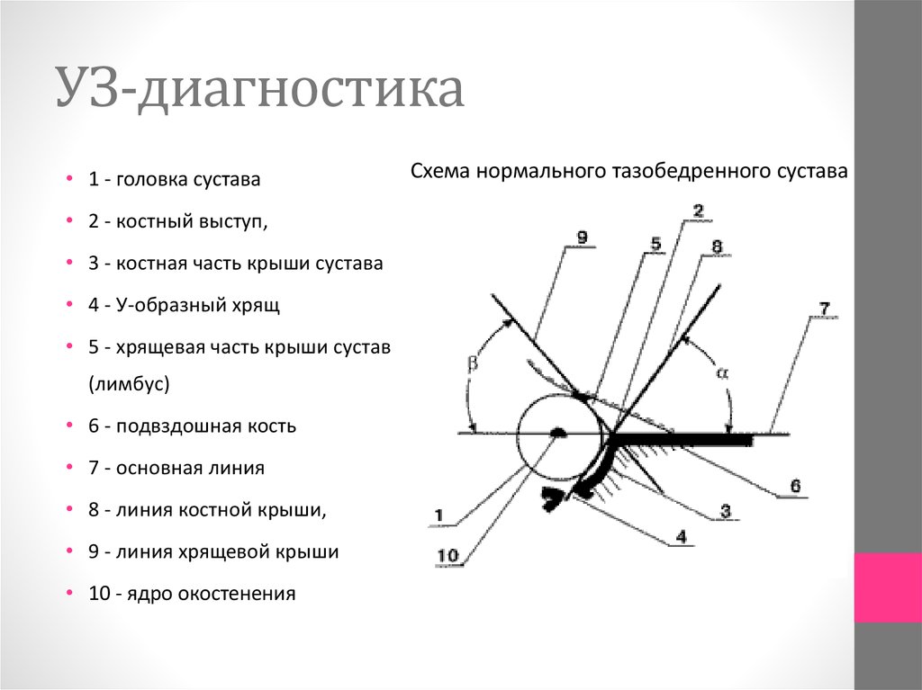 Тазобедренные суставы узи норма. УЗИ тазобедренных суставов по графу. УЗИ измерение углов тазобедренных суставов у. УЗИ тазобедренных суставов у новорожденных по графу. УЗИ тазобедренных суставов по графу норма.