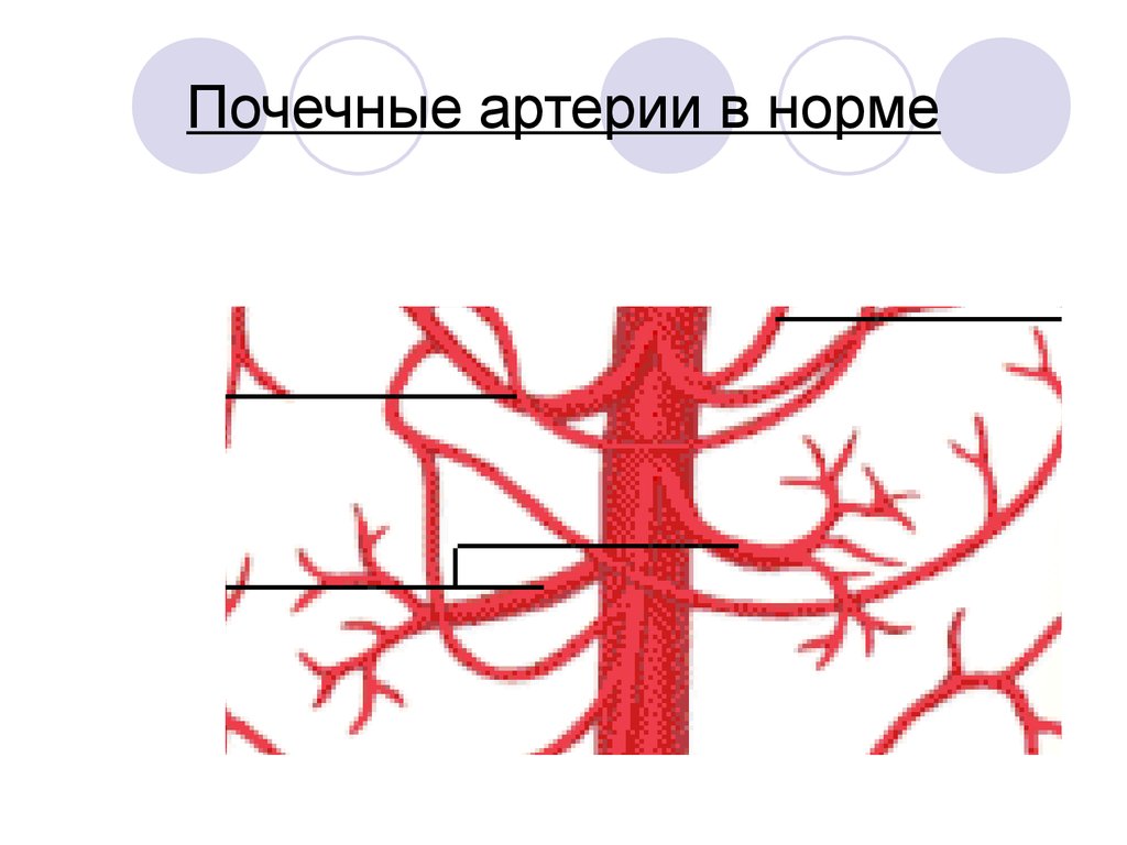Правая почечная артерия. Почечные артерии норма. Диаметр почечной артерии в норме. Нормальный диаметр почечной артерии. Внутрипочечные артерии.