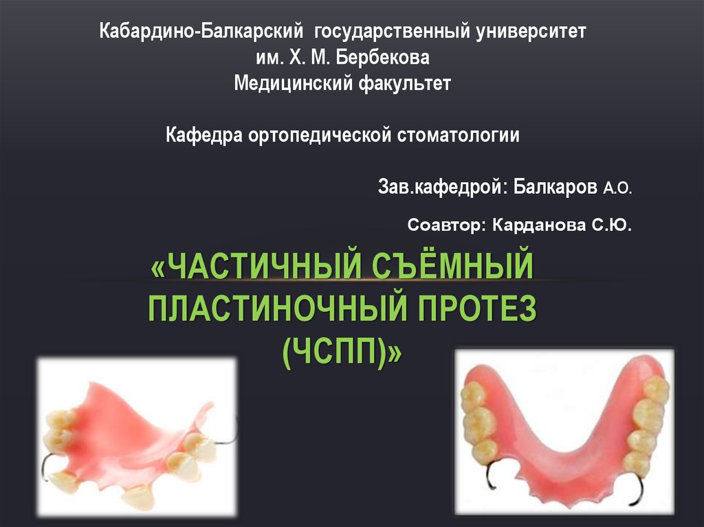 Пластиночный протез этапы. Частичный съемный пластиночный протез. Частичный съёмный пластиногчный протез. Частично съемный пластинчатый протез.