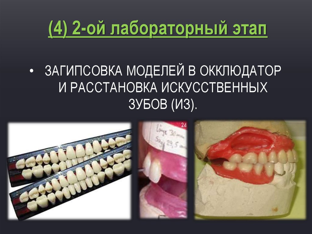 Искусственные зубы презентация