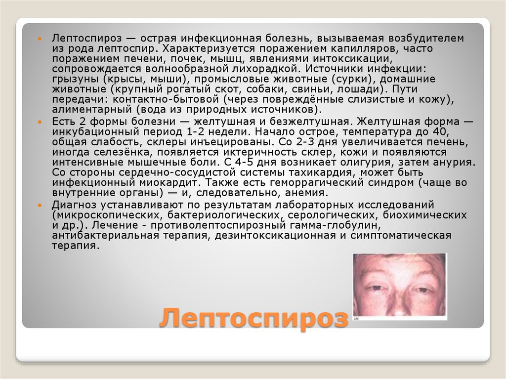 Лептоспироз это. Лептоспироз клинические проявления. Лептоспироз вид больного. Клинические симптомы лептоспироза. Клинические симптомы и синдромы при лептоспирозе.