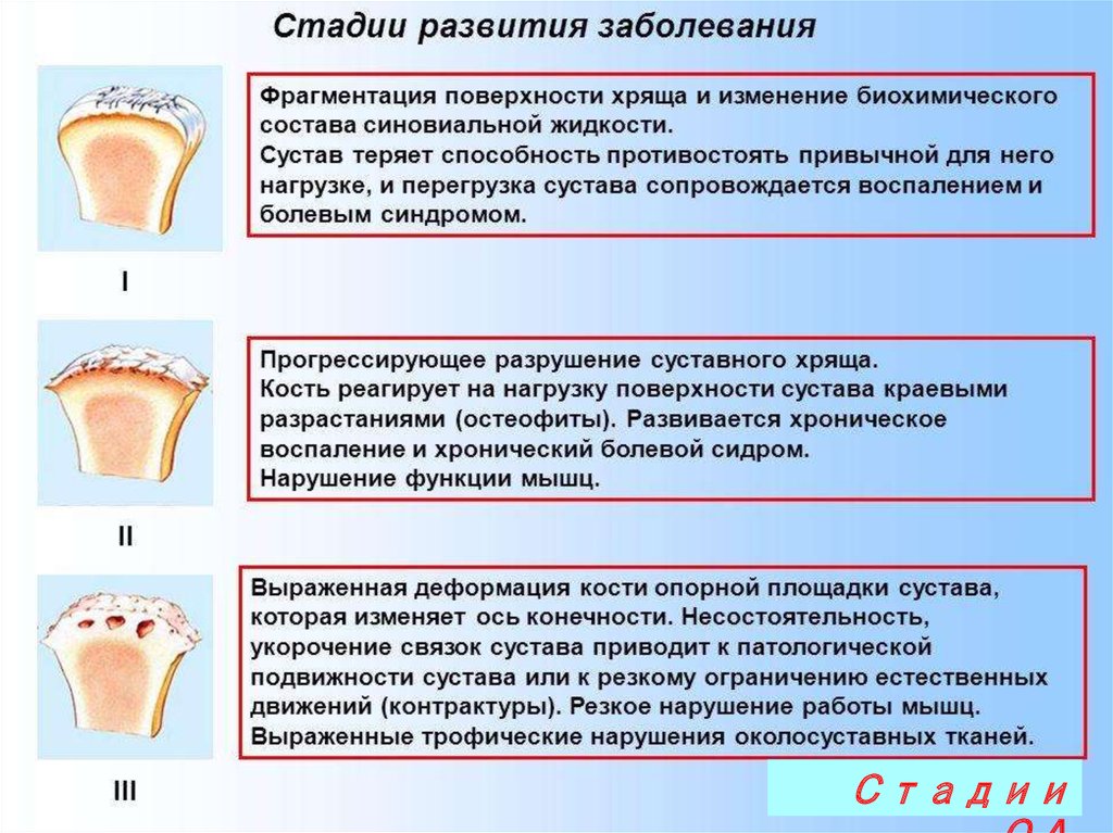 Стадии заболевания. Стадии поражения суставов. Стадии развития сустава. Степени поражения суставов. Суставные заболевания стадии.