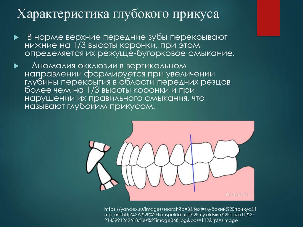 Зубы при закрытом рте. Правильный прикус вид снизу. Ортогнатический прикус зубы. Правильный ортогнатический прикус.