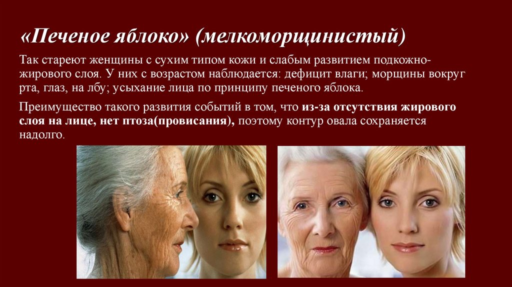 Факторы возрастных изменений. Возрастные изменения кожи лица. Возрастные изменения у женщин. Морщины возрастные изменения. Возрастные изменения кожи при старении.