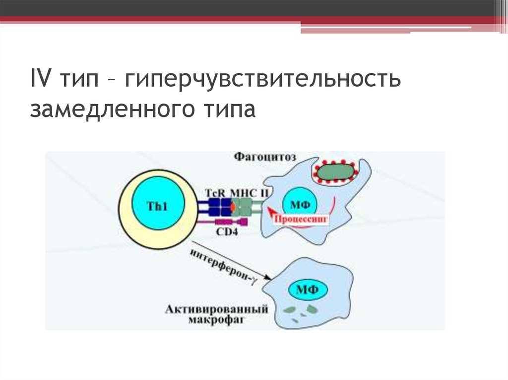 Типы гиперчувствительности. Механизм развития реакции гиперчувствительности замедленного типа. Схема реакции гиперчувствительности 4 типа. ГЗТ 4 Тип гиперчувствительности. Гиперчувствительность замедленного типа (ГЗТ).