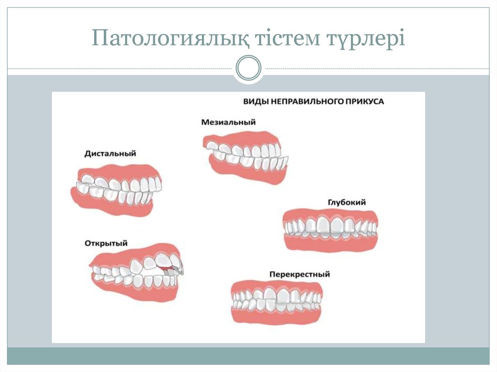 Тістем түрлері презентация