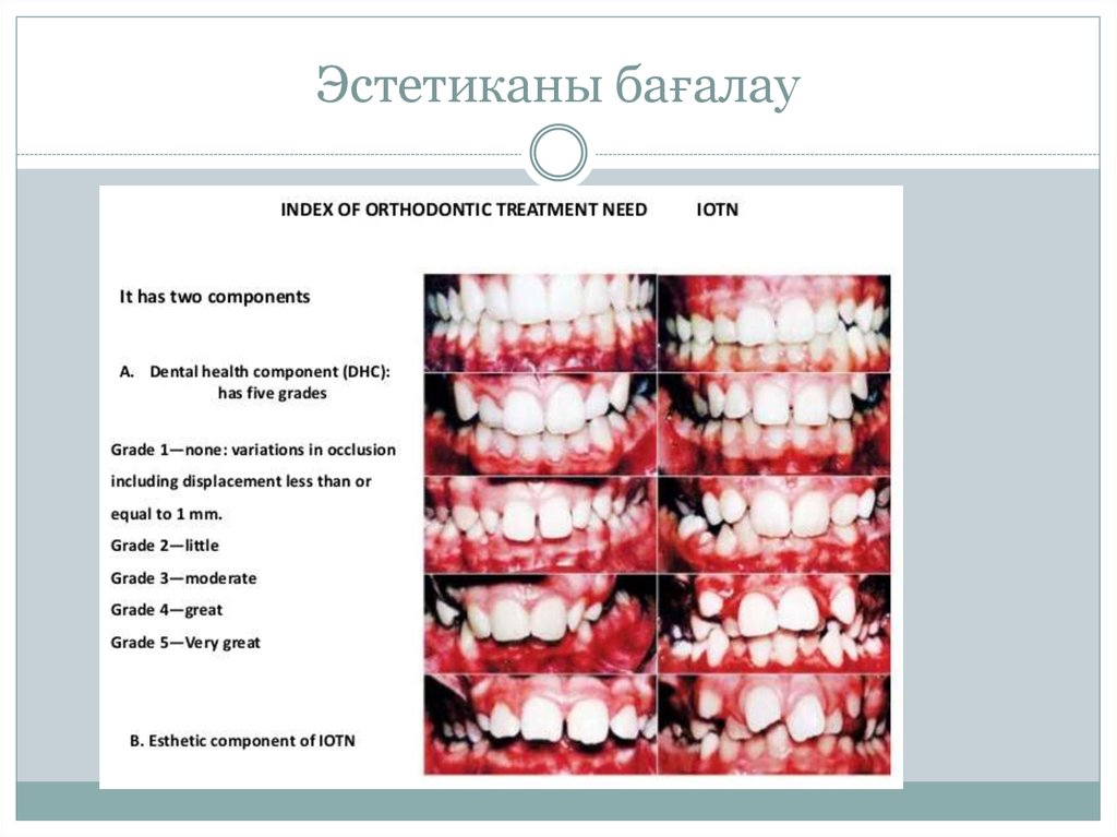 Эстетиканы бағалау