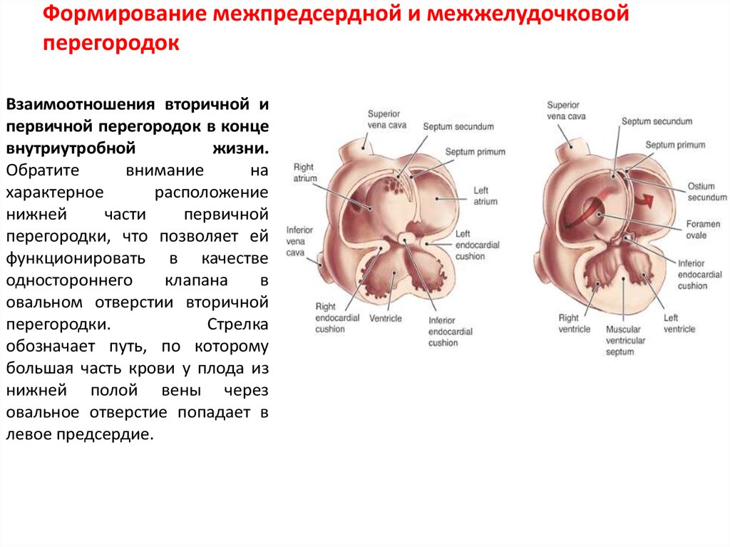 Межжелудочковая перегородка. Межпредсердная перегородка сердца строение. Анатомия межжелудочковой перегородки сердца. Аневризма межпредсердной перегородки типы ЭХОКГ. Строение межжелудочковой перегородки сердца.