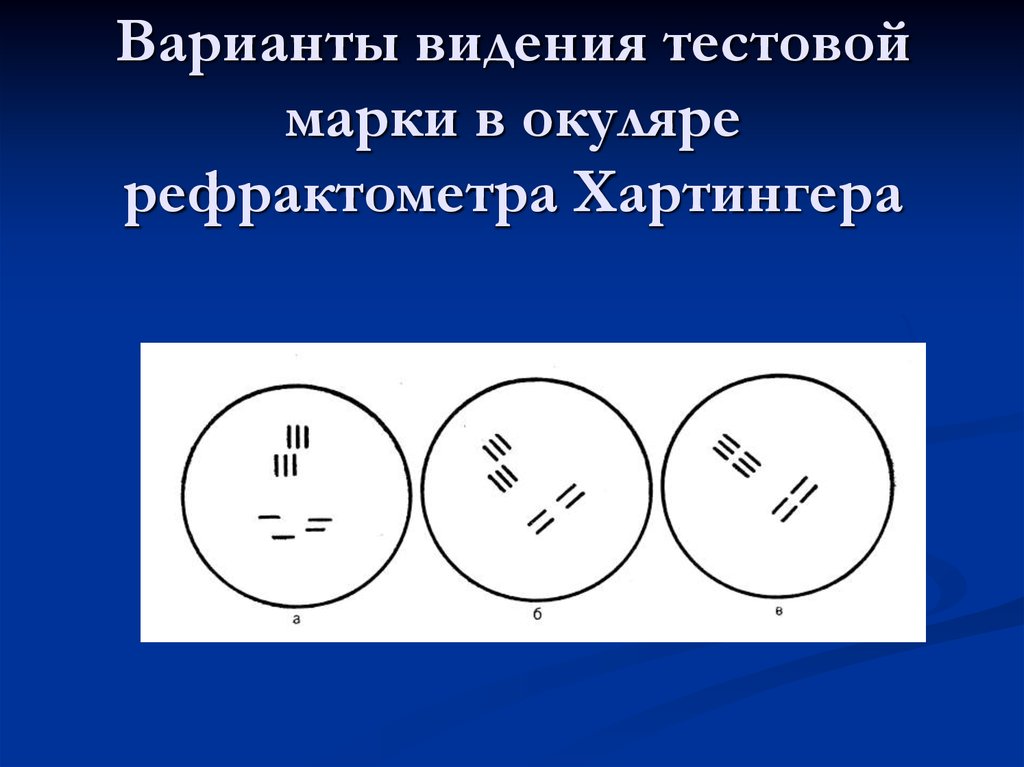 Варианты видишь. Рефрактометр Хартингера оптическая схема. Изображение в поле зрения окуляра рефрактометра. Рефрактометр Хартингера как работает. Принцип работы рефрактометра Хартингера.