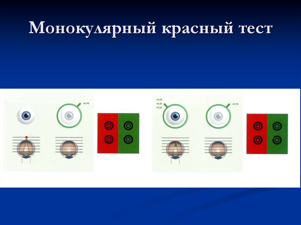 Тест красный. Монокулярный тест. Монокулярный признак композиция частей. Монокулярное осложнение. Красный тест.