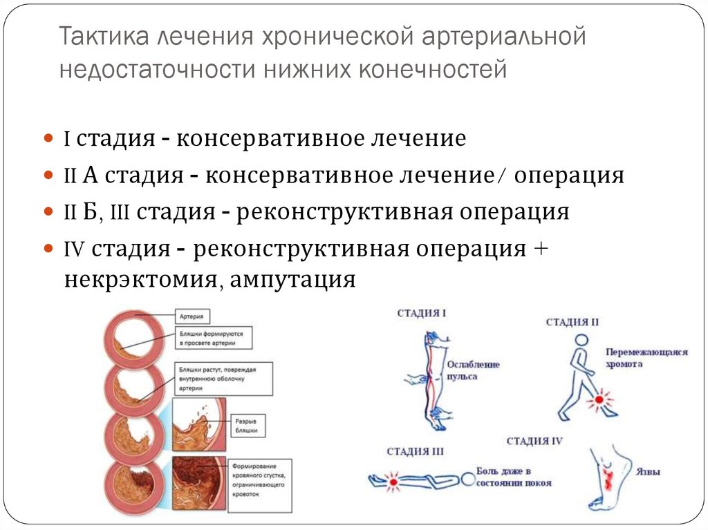 Нарушение кровообращения хирургия