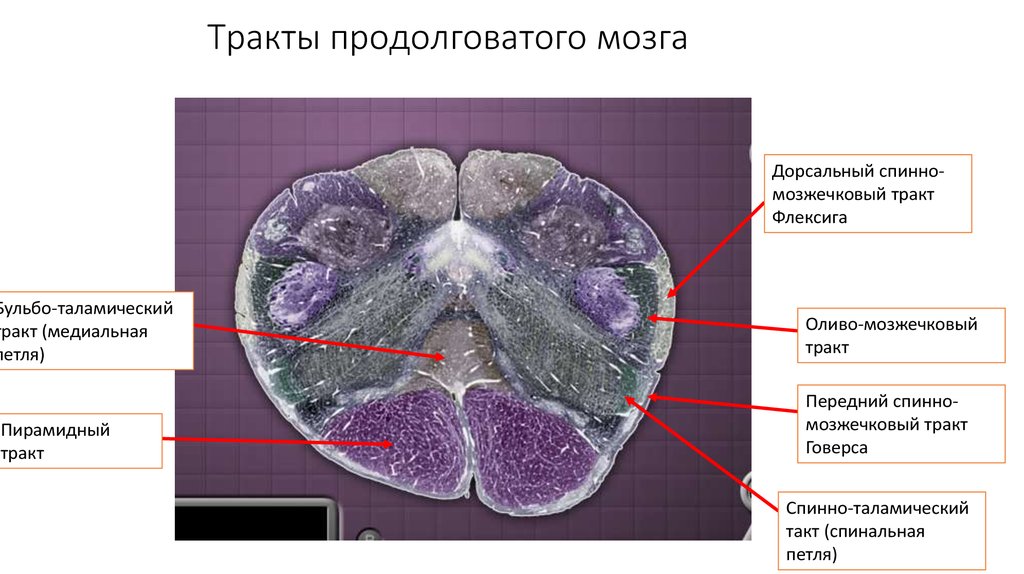 Ядра продолговатого мозга. Пирамидный тракт продолговатого мозга. Оливное ядро продолговатого мозга. Клиновидное ядра продолговатого мозга. Ядра оливы продолговатого мозга.