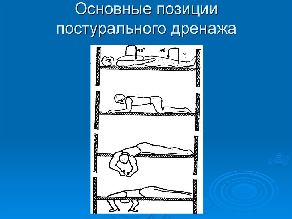 Дренажное положение. Позиционный (Постуральный) дренаж. Постуральный дренаж положение Квинке. Положение постурального дренажа. Постурального (позиционного) дренажа.