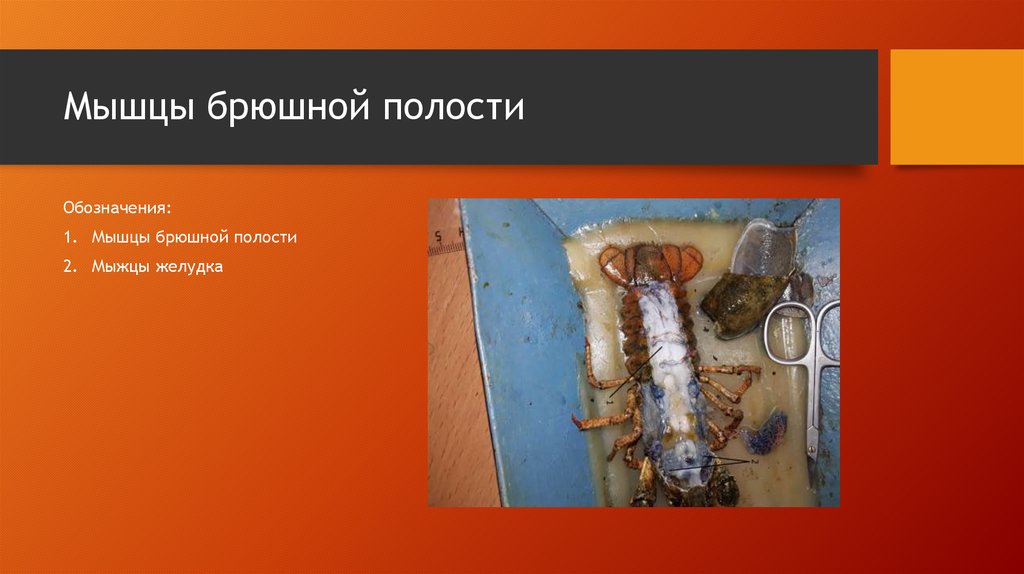 Мышцы брюшной полости