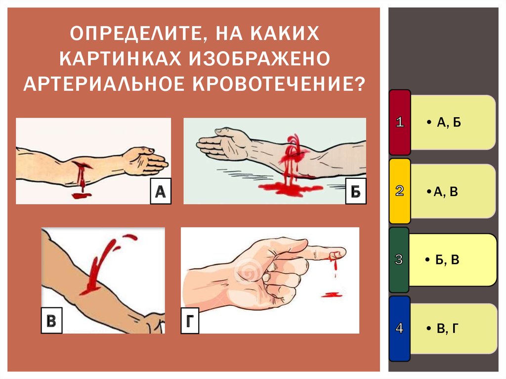 Kak pri. Артериальное кровотечение. Измерить артериальное кровотечение. Первая помощь кровотечение артериальное аптечка. Артериальное кровотечение рисунок.