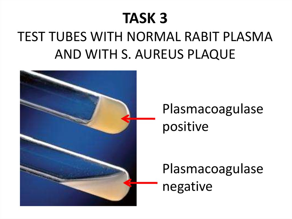 Third test. Реакция плазмокоагуляции. Plasmacoagulase Test.