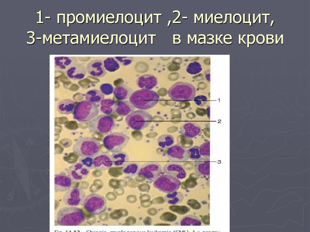 Промиелоциты в крови фото под микроскопом