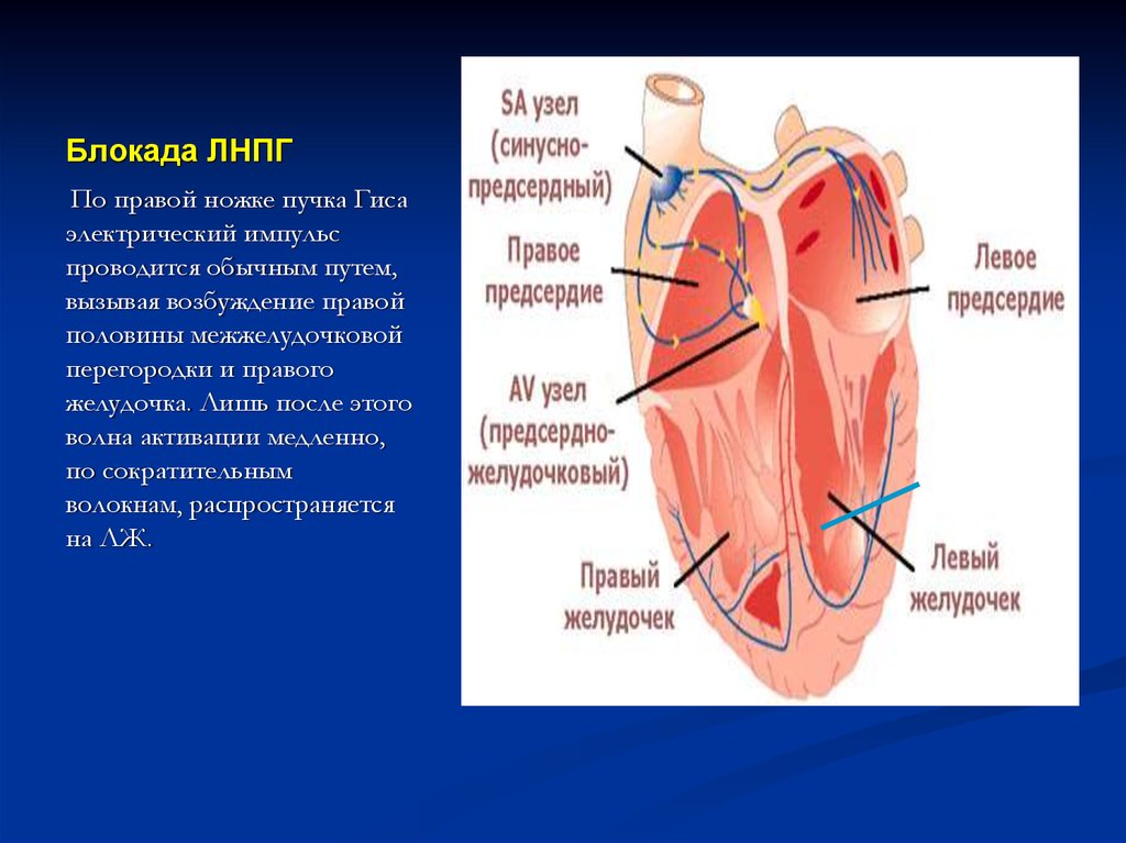 Правая ножка гиса