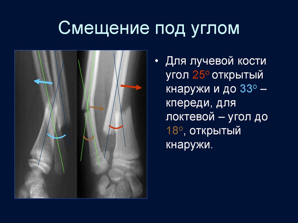 Лучевая диагностика костей презентация