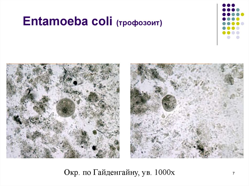Entamoeba coli в кале. Entamoeba coli циста. Entamoeba histolytica под микроскопом. Кишечная амеба (Entamoeba coli). Entamoeba histolytica жизненный цикл.