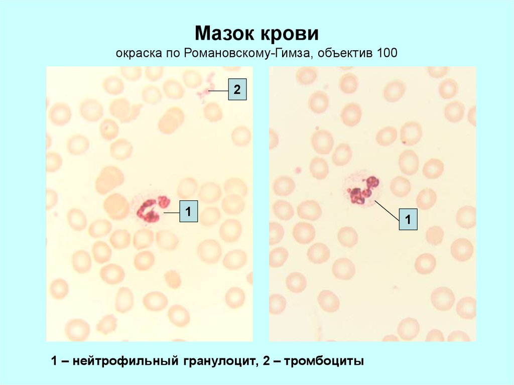 Тромбоциты в мазке крови фото